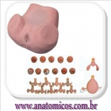 Simulador Ginecolgico com tero Saudvel e Patolgicos