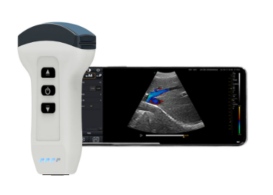 Ultrassom POCUS  Port�til  Alta Defini��o Point of Care?cache=20240903201851